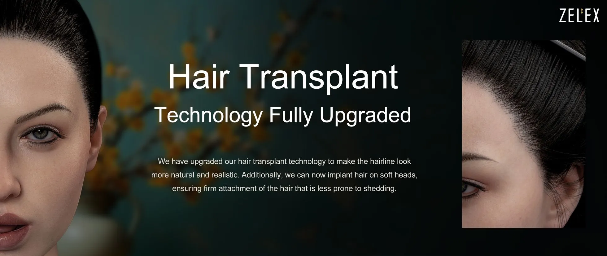 Hair transplant technology fully upgraded.