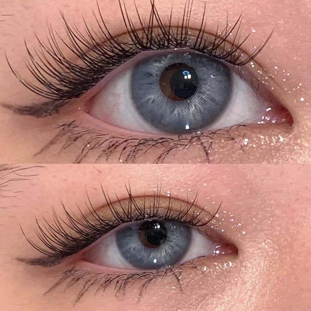 Eyeza Irish Blue | 1 Year