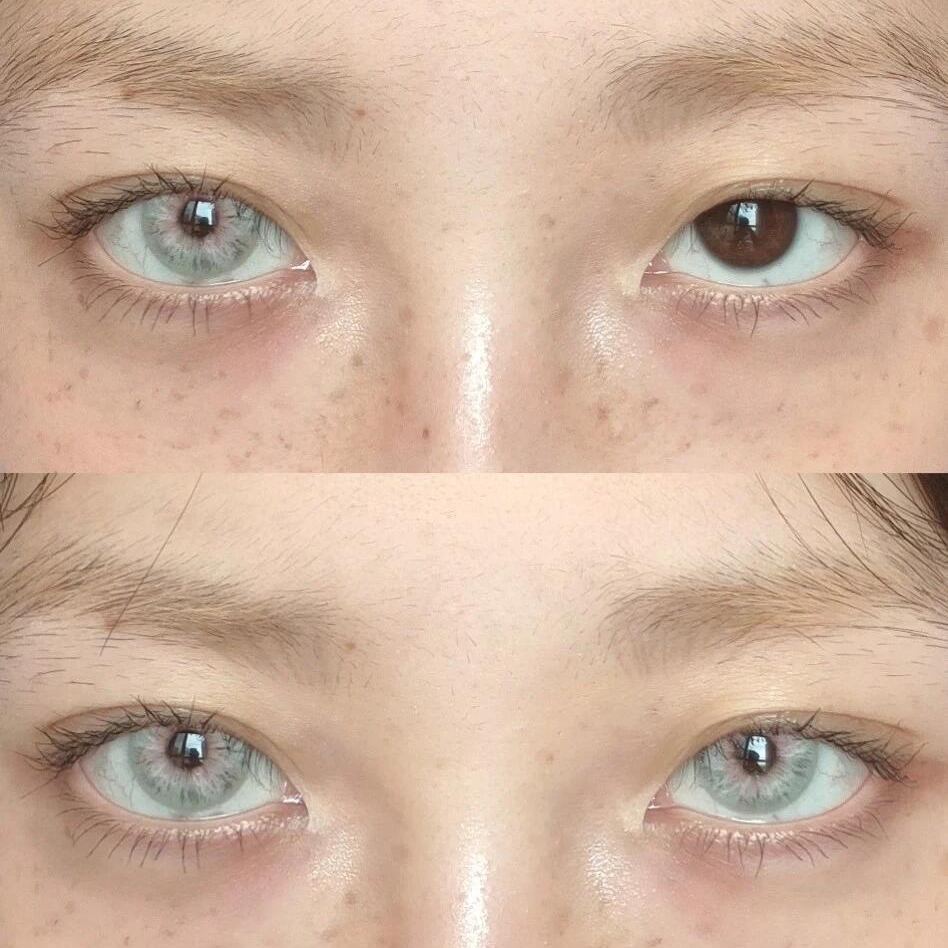 Eyeza Eclipse Silver | 6 Months