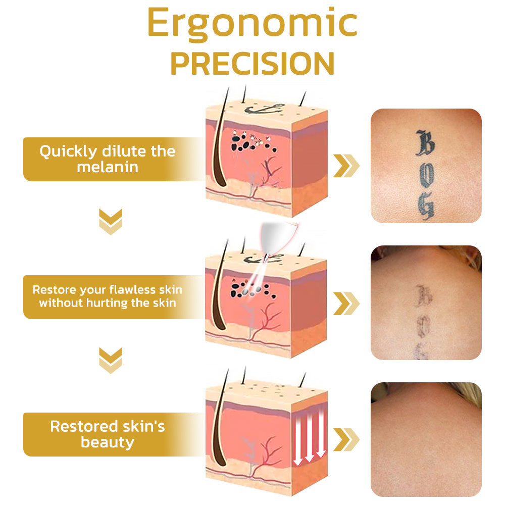 Caneta de beleza elétrica profissional Remifa™ Spotifly