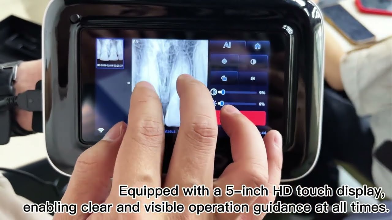 Dental X Ray With Sensor AI Diagnosis