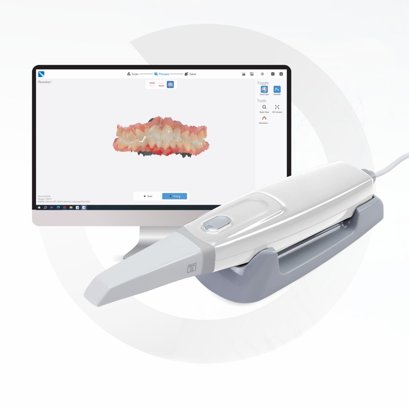 3D Dental Scanner Intraoral Imaging System