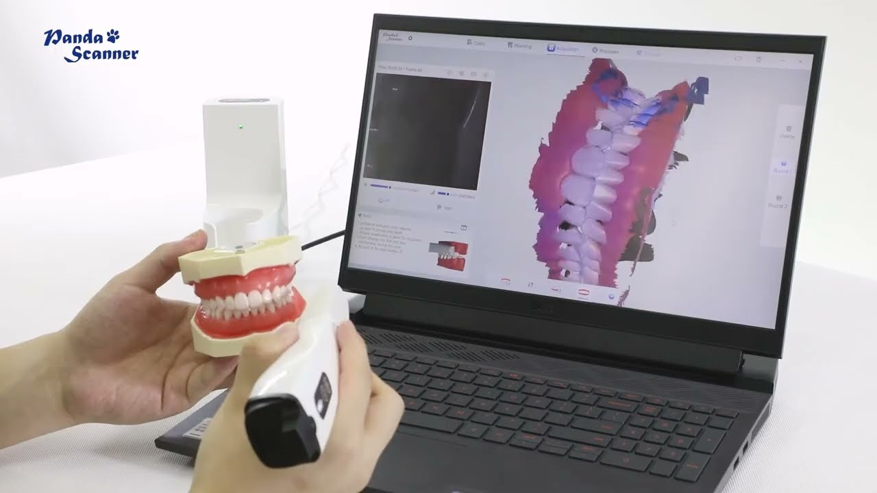 3D Wireless Intraoral Scanner Digital System