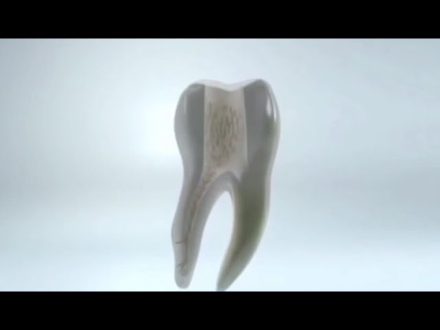 Cordless Ultrasonic Irrigator Dental Endo Activator