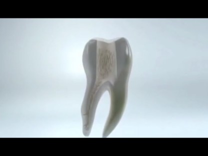 Cordless Ultrasonic Irrigator Dental Endo Activator