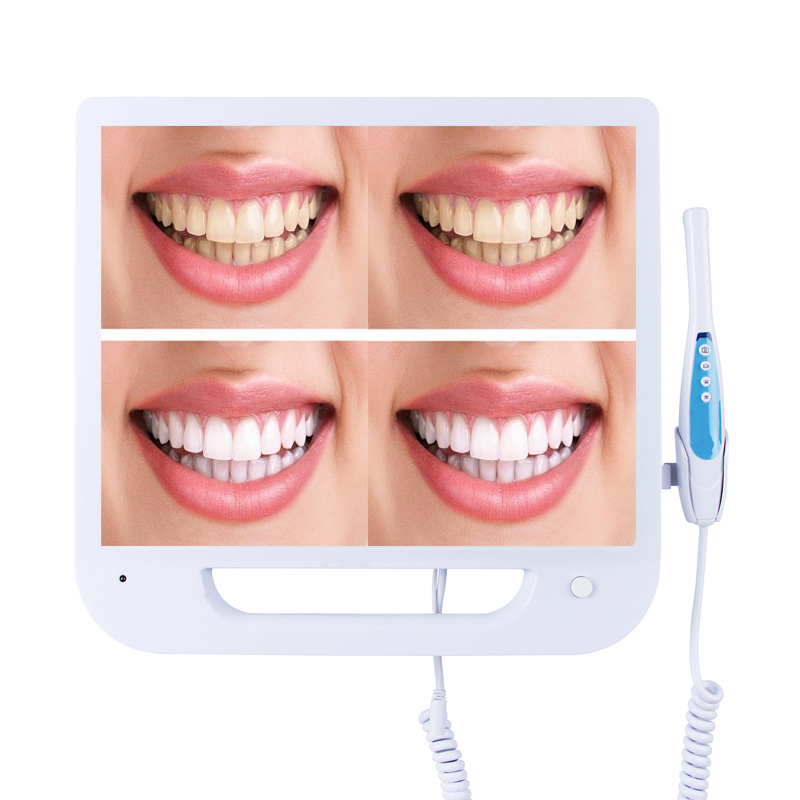 Dental Oral Camera 17 Lcd Inch Monitor