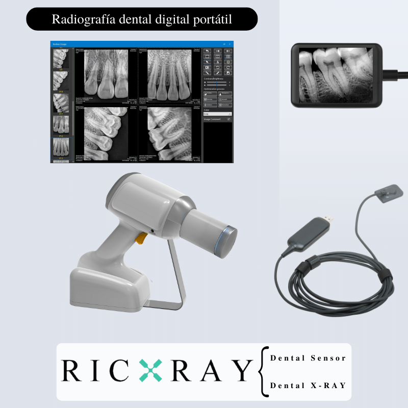 Digital Dental X Ray And Rvg Sensor