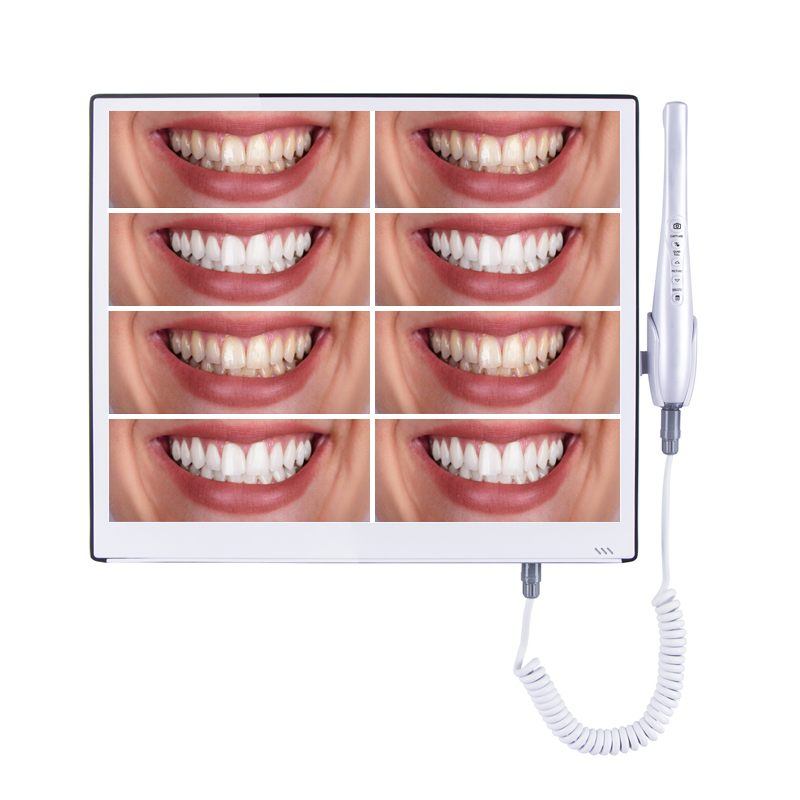 Intra Oral Camera Wifi 17 Inch Lcd Monitor