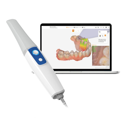 3D Intraoral Scanner Digital Accurate Intelligent