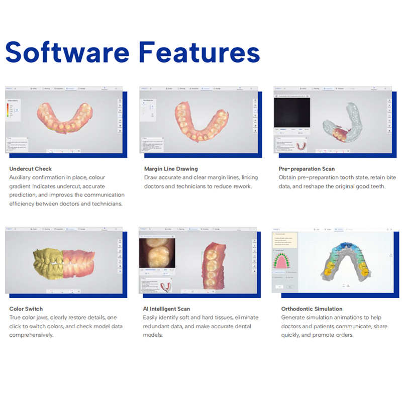 3D Wireless Intraoral Scanner Digital System