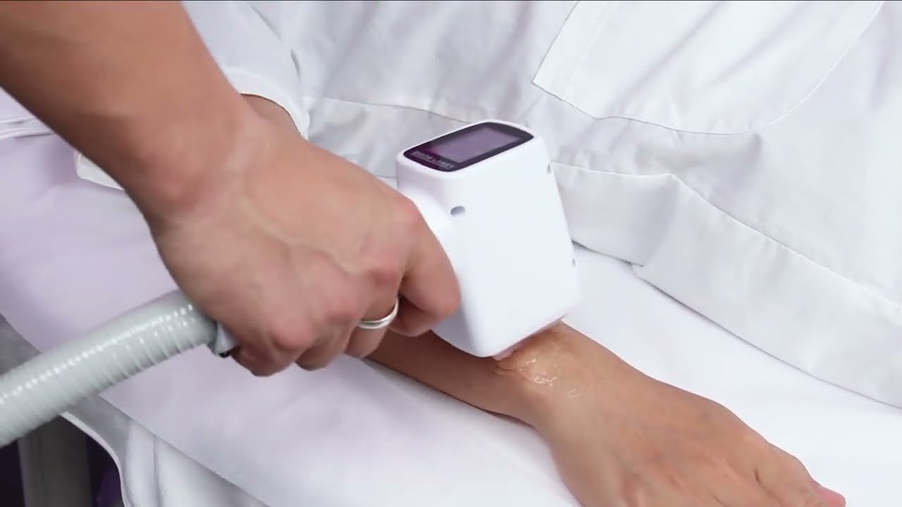 808NM Diode Laser Hair Removal 1000W 2000W