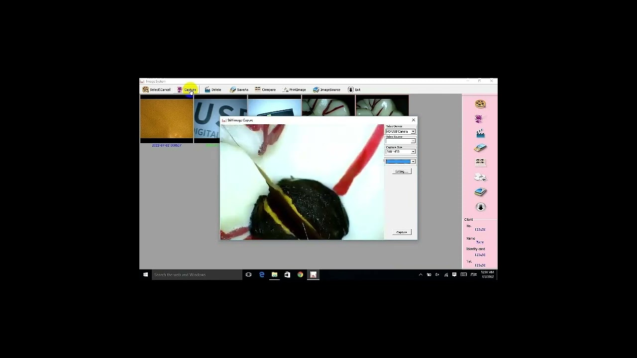 Portable Intraoral Camera USB Endoscrope