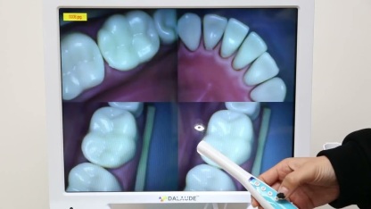 Dental Oral Camera 17 Lcd Inch Monitor
