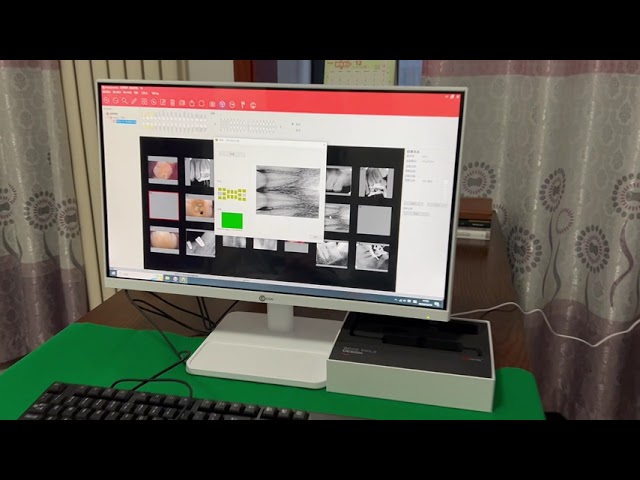 Intraoral Sensor Digital Imaging System Handy