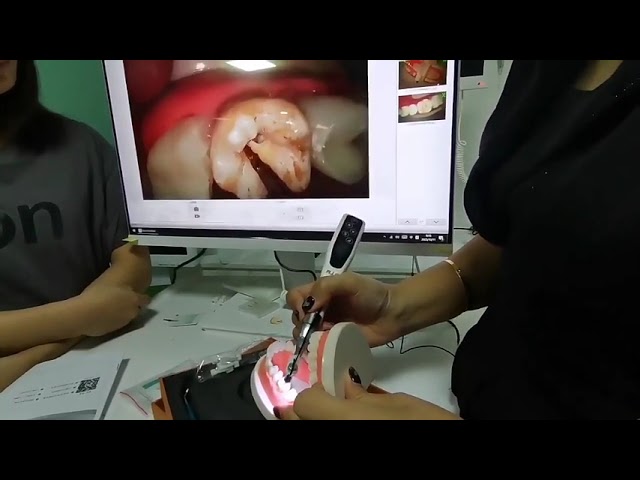 Dental Intraoral Camera Visual Micro Oral Digital Observation
