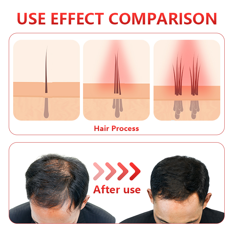 RED LIGHT THERAPY CAP FOR HAIR REGROWTH OR BRAIN HEALTH 