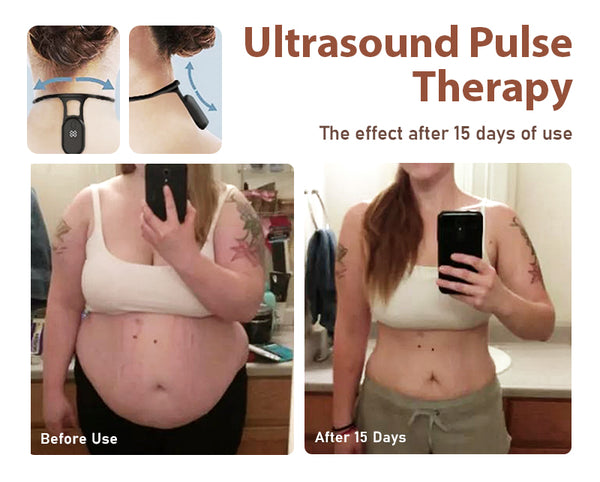 ANWX SLIMORY 超声波淋巴舒缓颈部仪