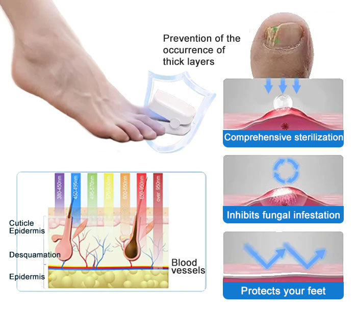 🔥Hot Sale ⚡ 70% OFF🎁Nail Fungus Cleaning Laser Device