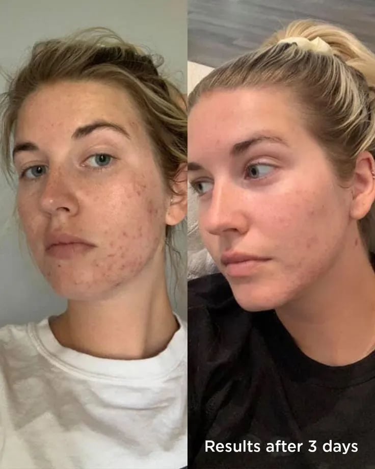 滚动 Pin 图图片 7