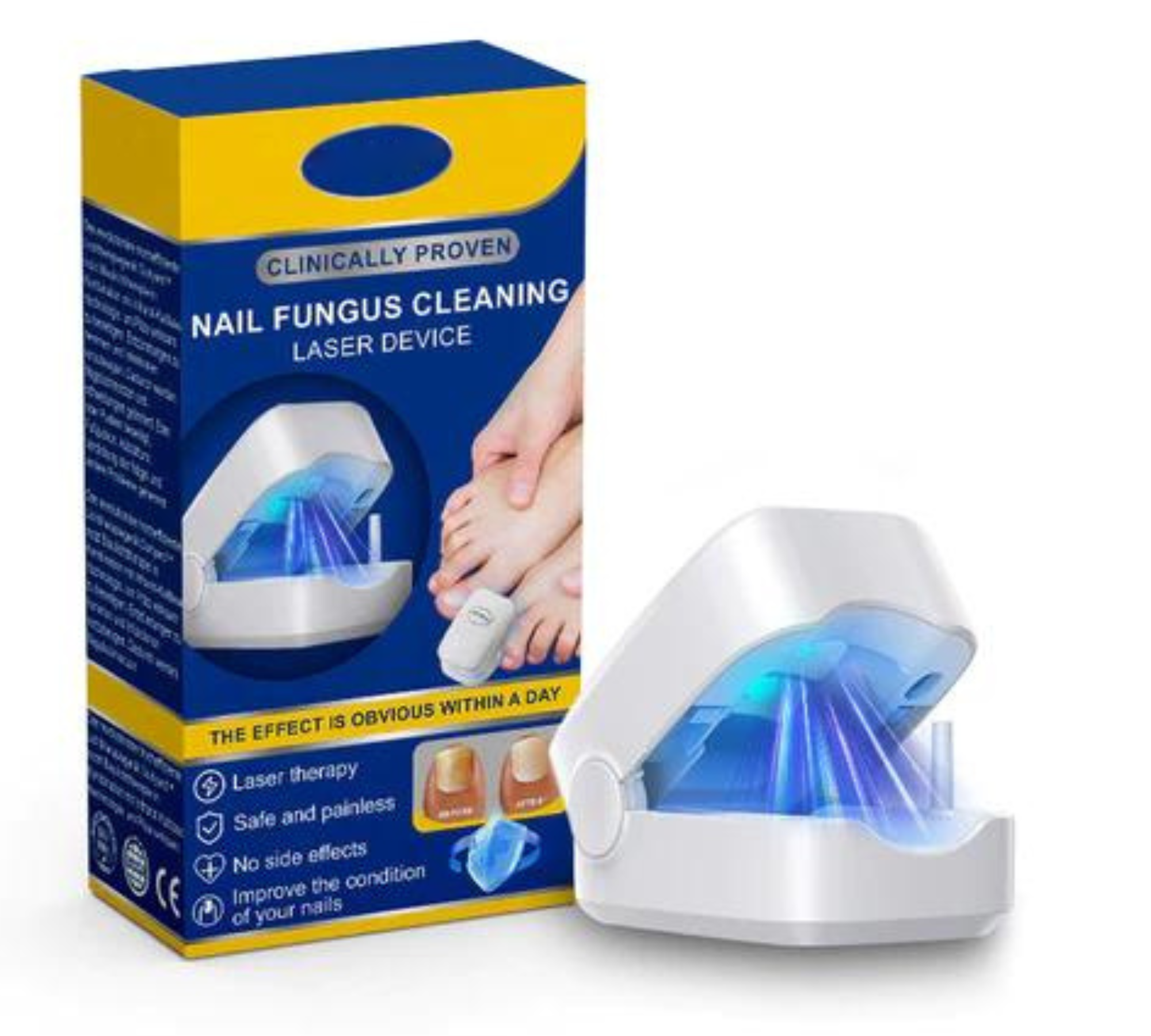 🔥Hot Sale ⚡ 70% OFF🎁Nail Fungus Cleaning Laser Device