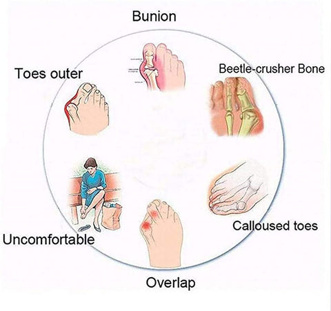 BunionFree&trade; Bunion Correction Sandals for Women