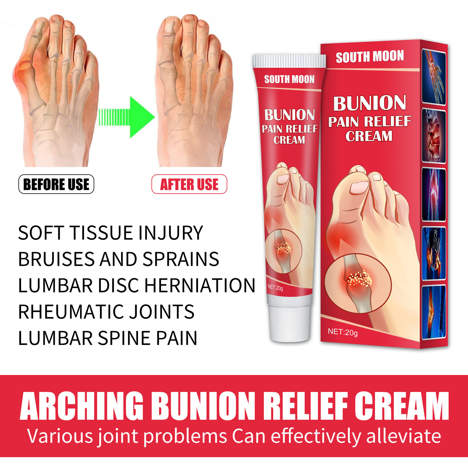 Bunion Pain Relief Cream