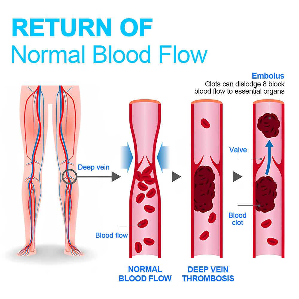 💎Made In USA💎PEARLMOON™ Ionic Correction Lymphatic Detoxification Long Tube Silk Stockings (⭐⭐⭐⭐⭐limited time offer, lasts 30 minutes)