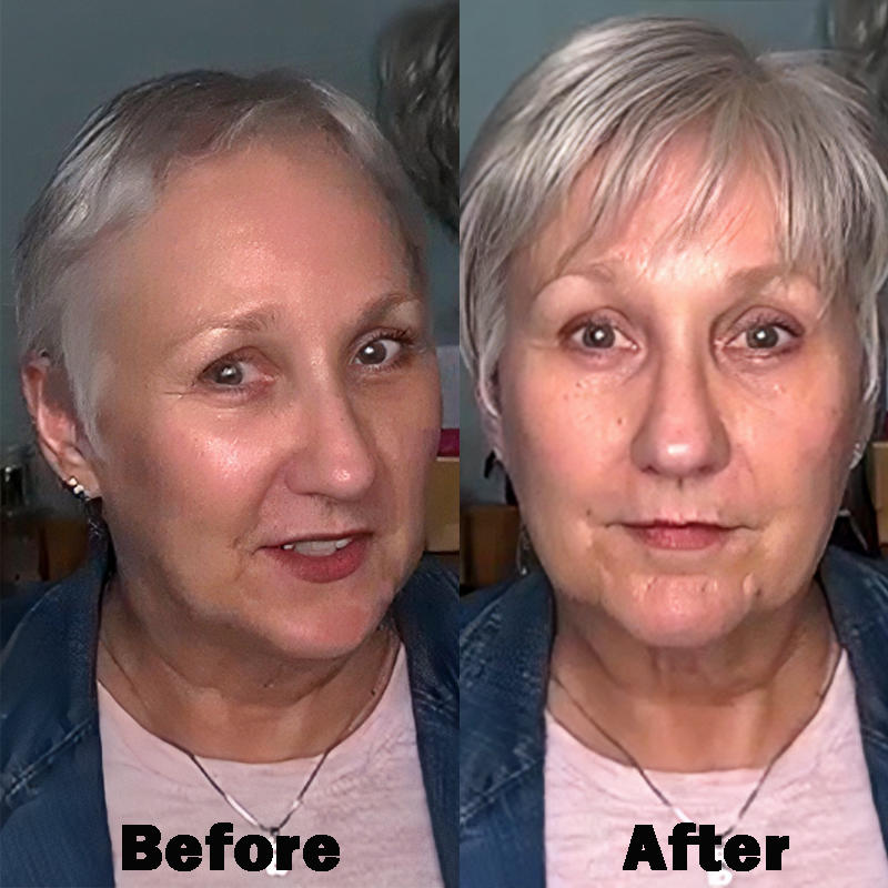 SUMMER HOT SALE🔥 65% OFF|SHORT NATURAL HAIR TOPPERS With Bangs