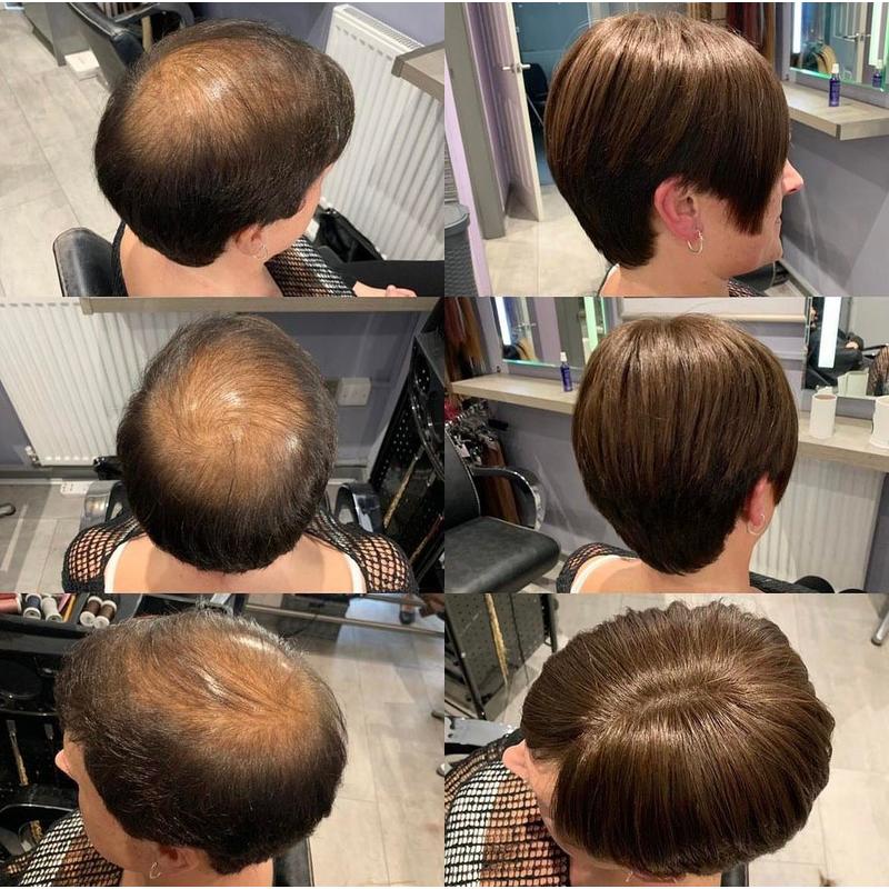 SUMMER HOT SALE🔥 65% OFF|SHORT NATURAL HAIR TOPPERS With Bangs