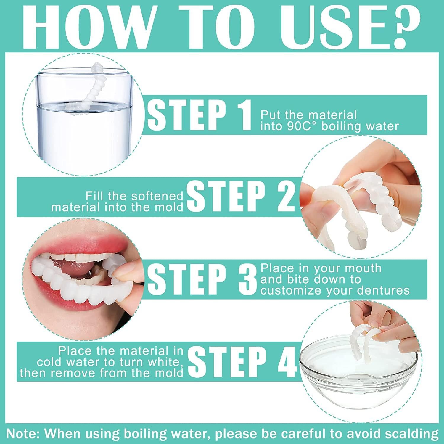 GleamSmile™ Snap-On Dentures- Affordable Smile Design- No Dentist