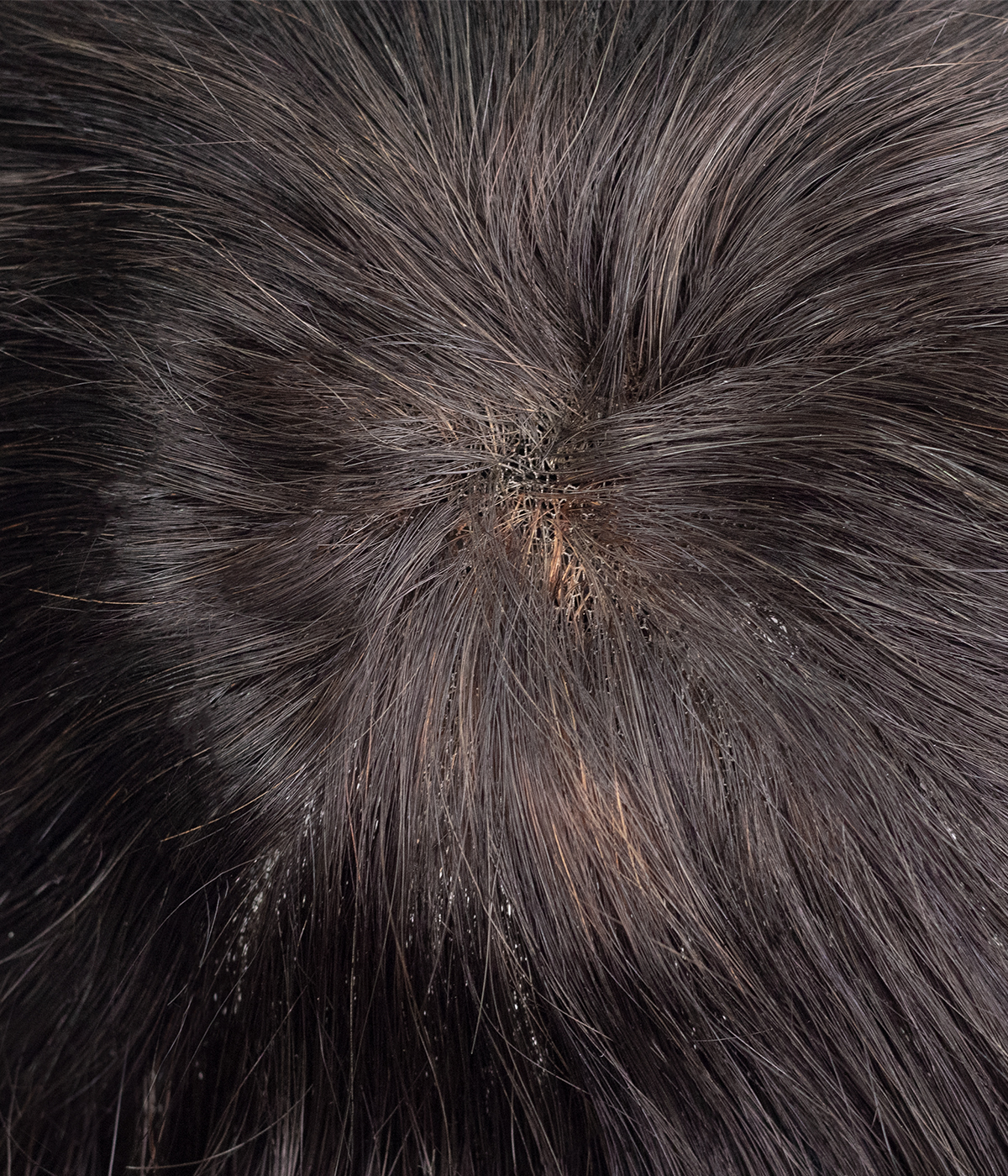 PRACTICE MEN HAIR SYSTEMS - Hollywood- 8"x10" Lace Hair System For Men | Soft and Durable