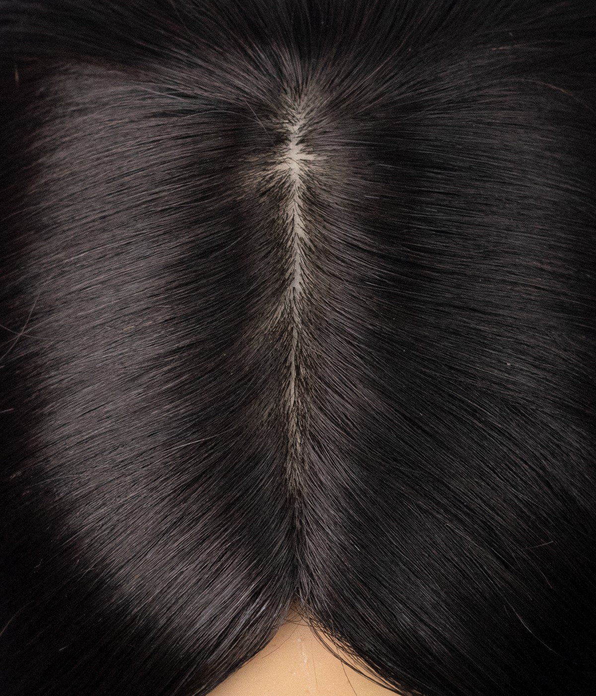 7.5” X 7.5” Skin Top Remy Human Hair Topper | Natural Looking Hair Parting | No Hair Returns 