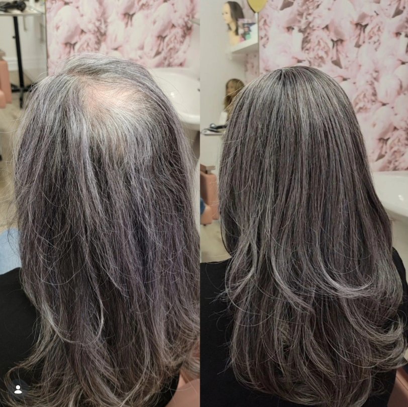 Before/After