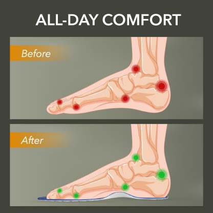 Deep Relief Massage Acupressure Insoles