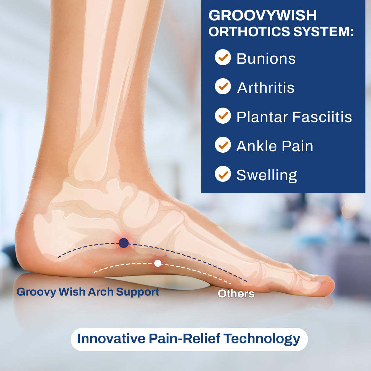 Orthopedic Sandals For Women Comfortable Casual Cross Strap Flip-flops