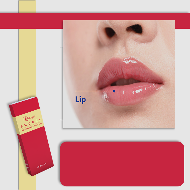 buy lip filler online