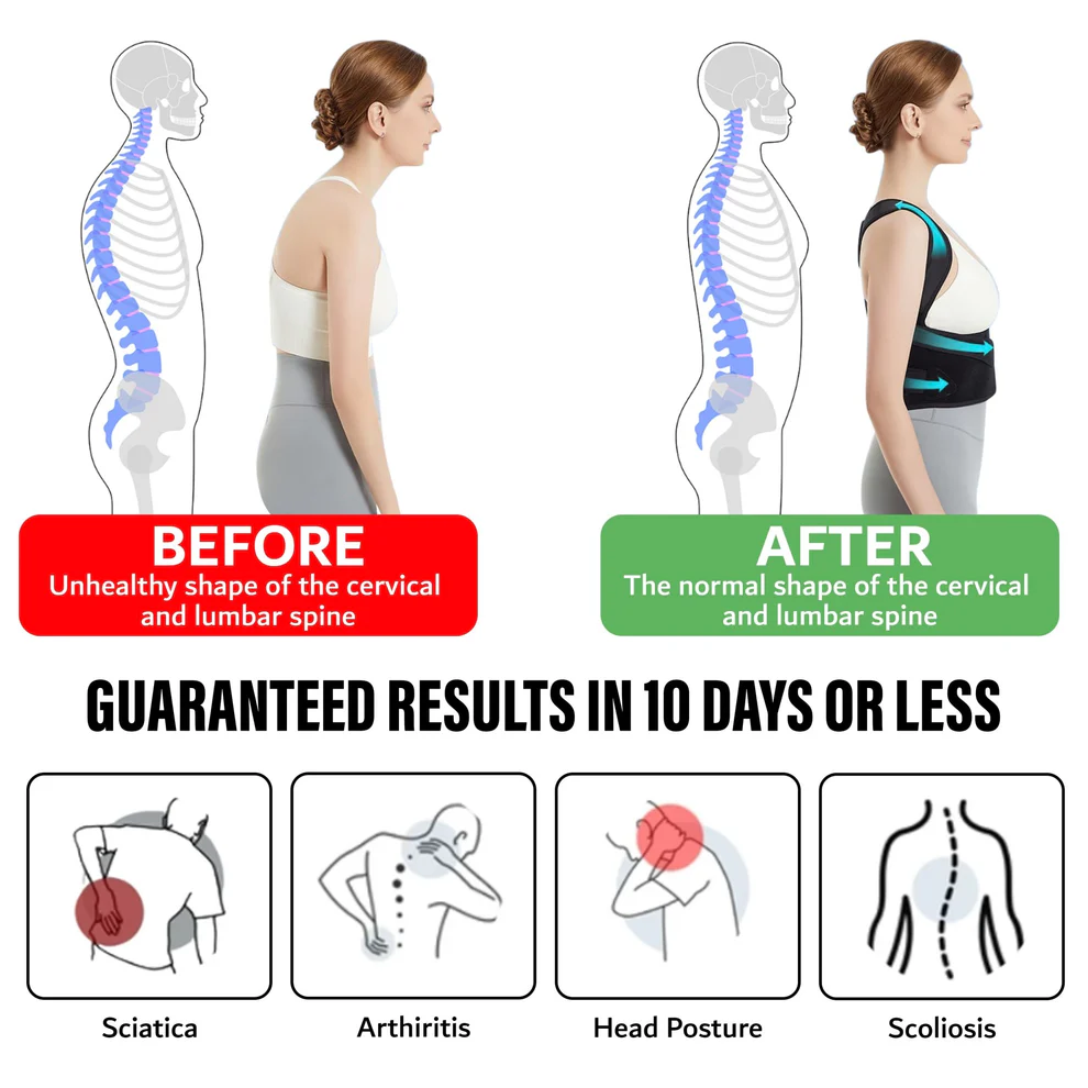 Posture Corrector