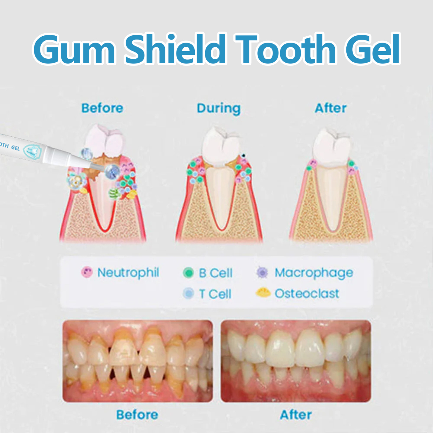 Teeth Whitening Gel Pen – Brighten & Care for Gums