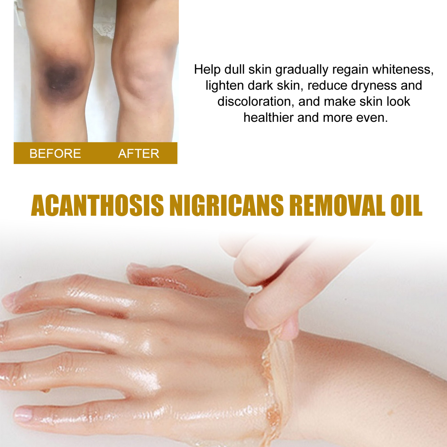 Exfoliating Oil – Fade Black Spots & Brighten