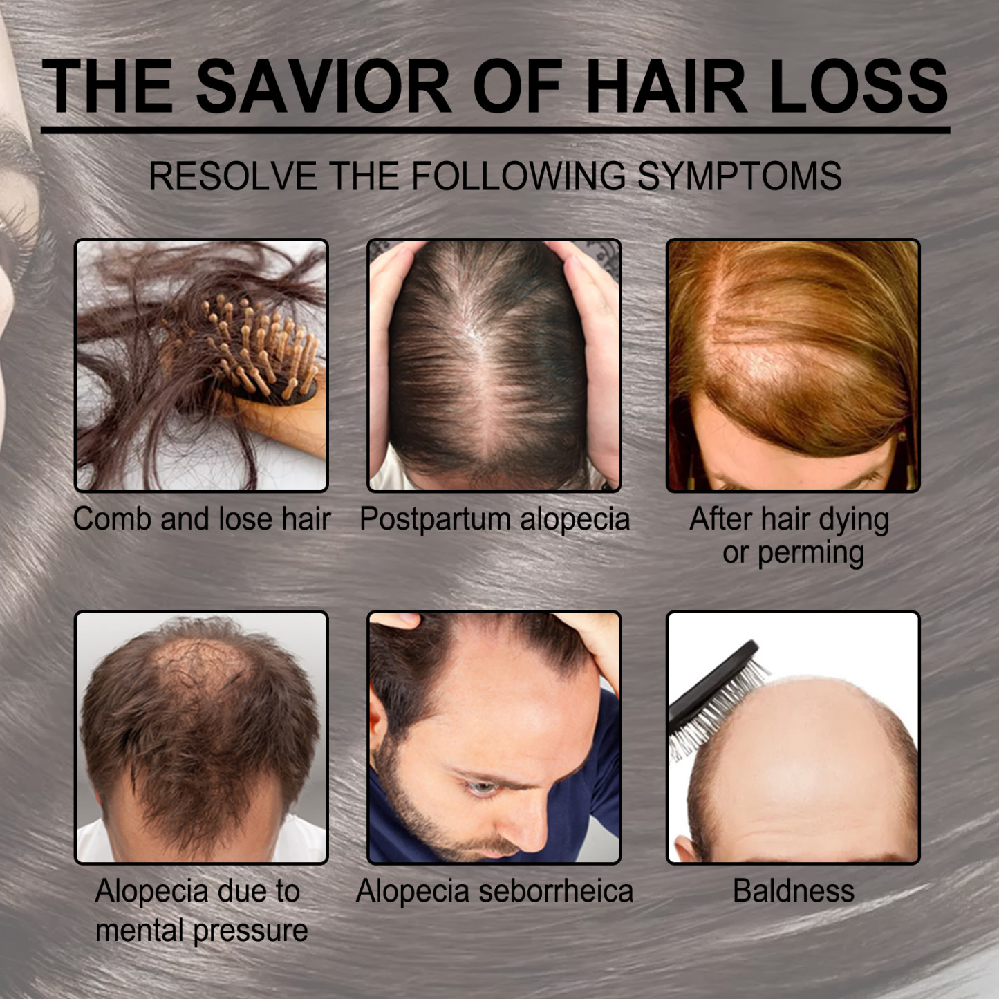 Rosemary Hair Oil – Smooth, Volumize & Soothe the Scalp