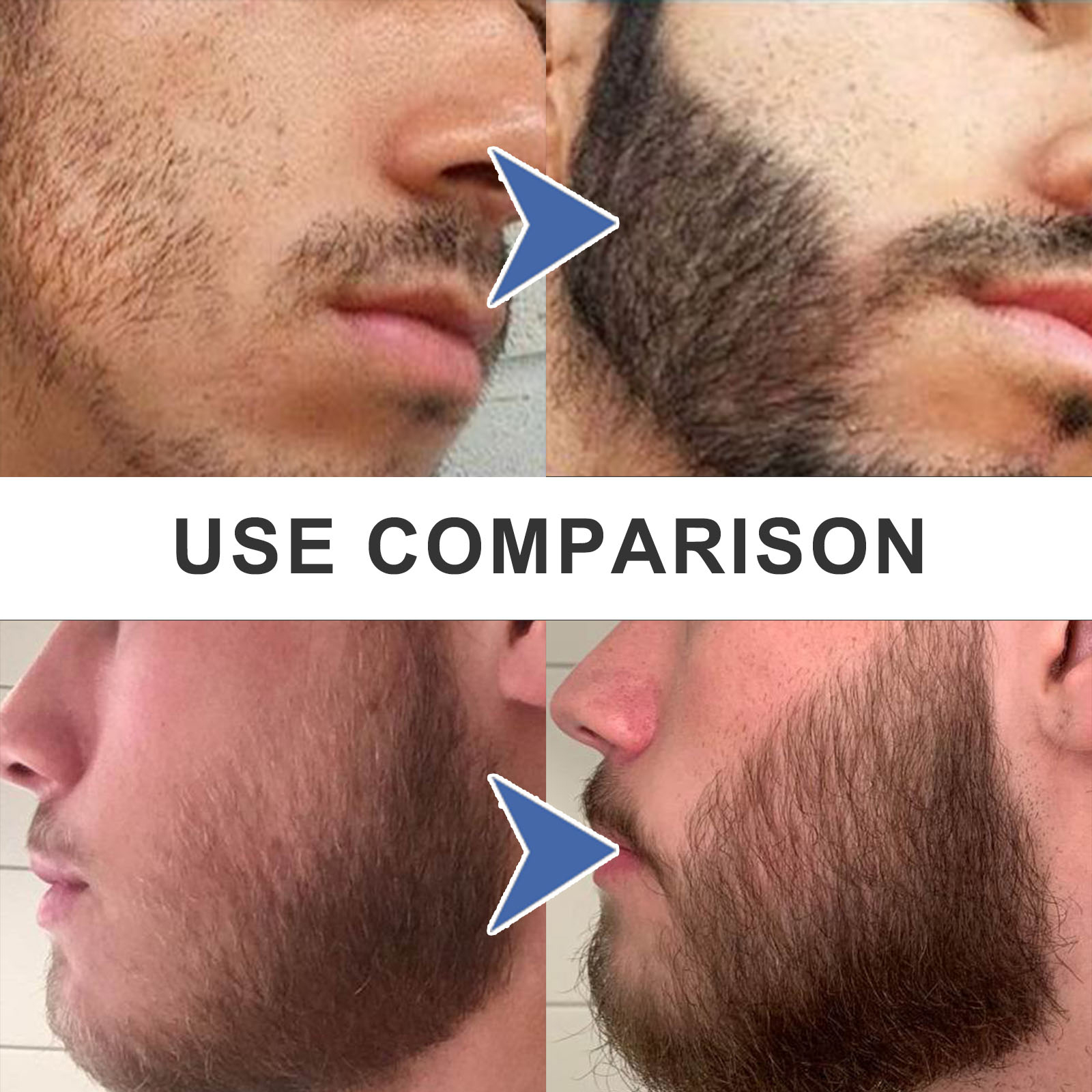 Beard Filler Pen – Shape & Enhance