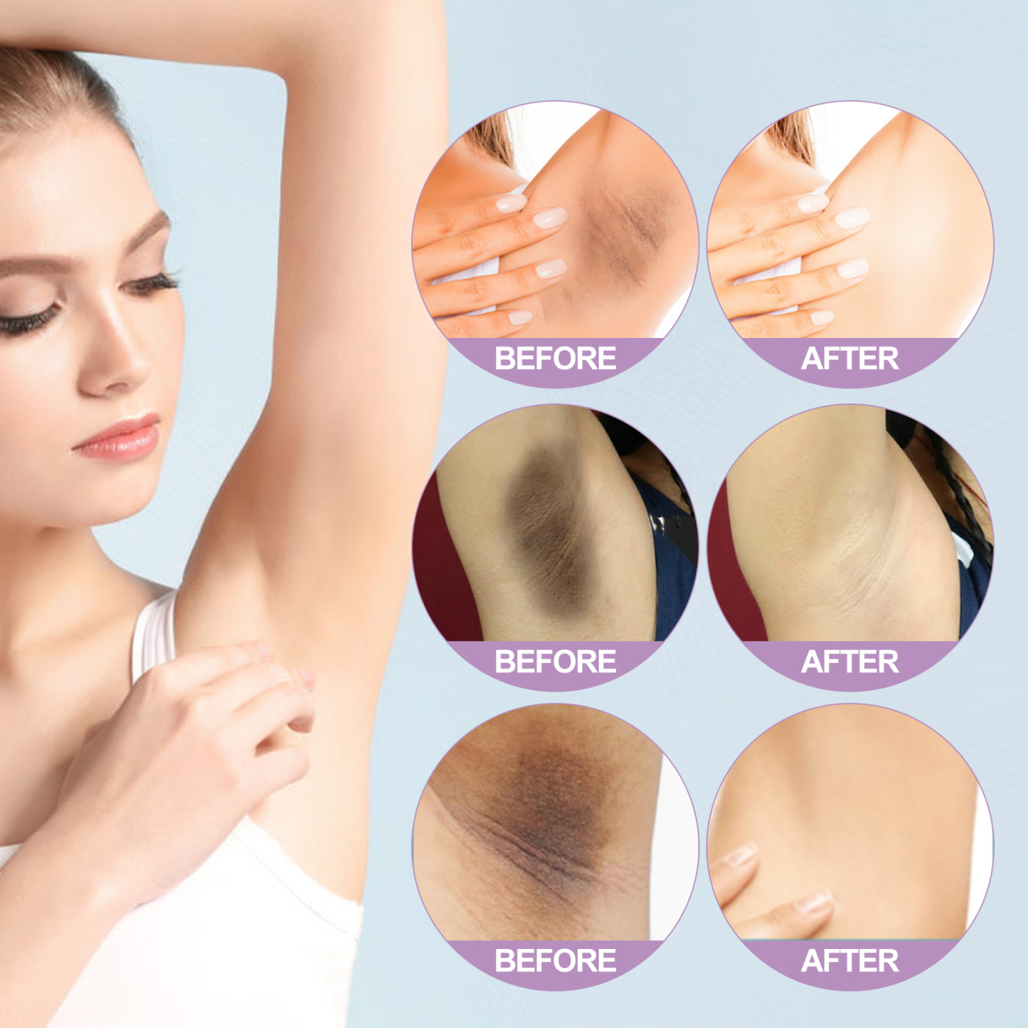 Underarm Whitening Essence – Brighten & Hydrate