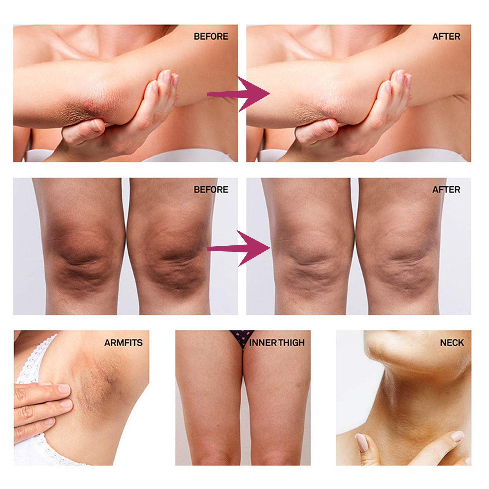 Armpit Whitening Cream – Underarm & Joint Melanin Repair, Skin Brightening & Moisturizing Cream