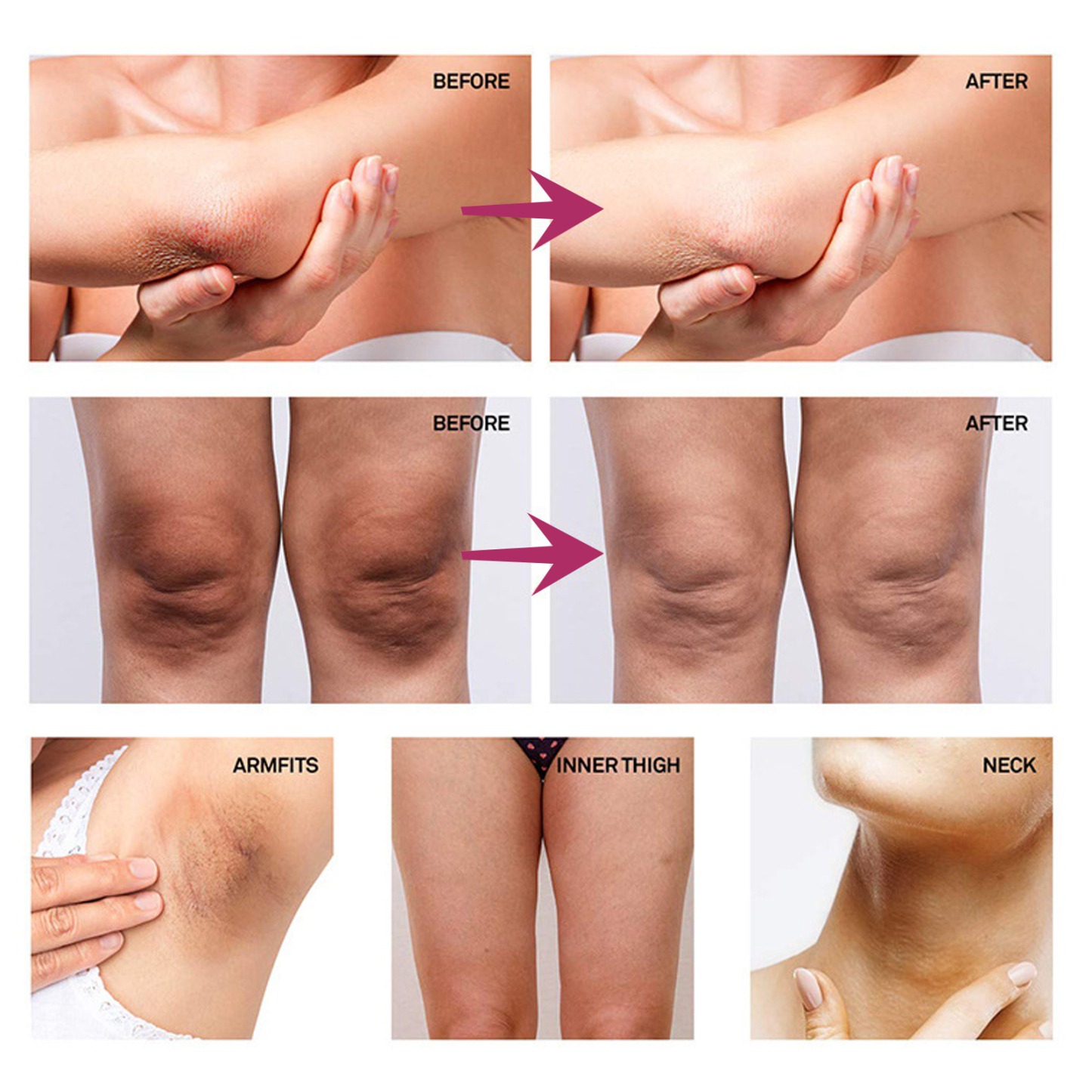 Armpit Whitening Cream – Underarm & Joint Melanin Repair, Skin Brightening & Moisturizing Cream