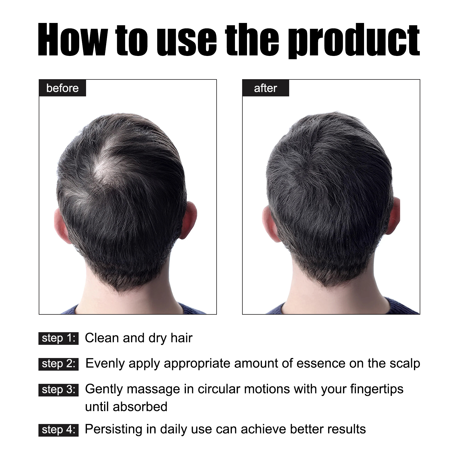 East Moon Men's Hair Thickening Serum – Boost Density & Strengthen Hair