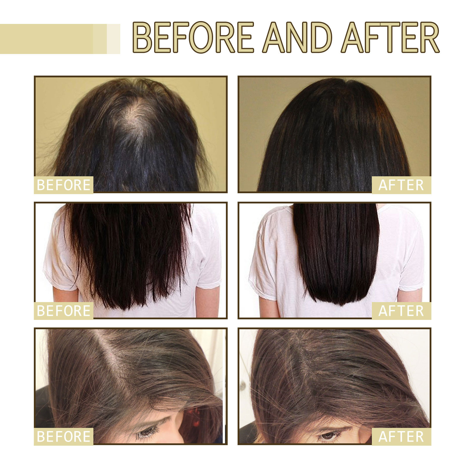 Rosemary Hair Oil – Grow & Smooth