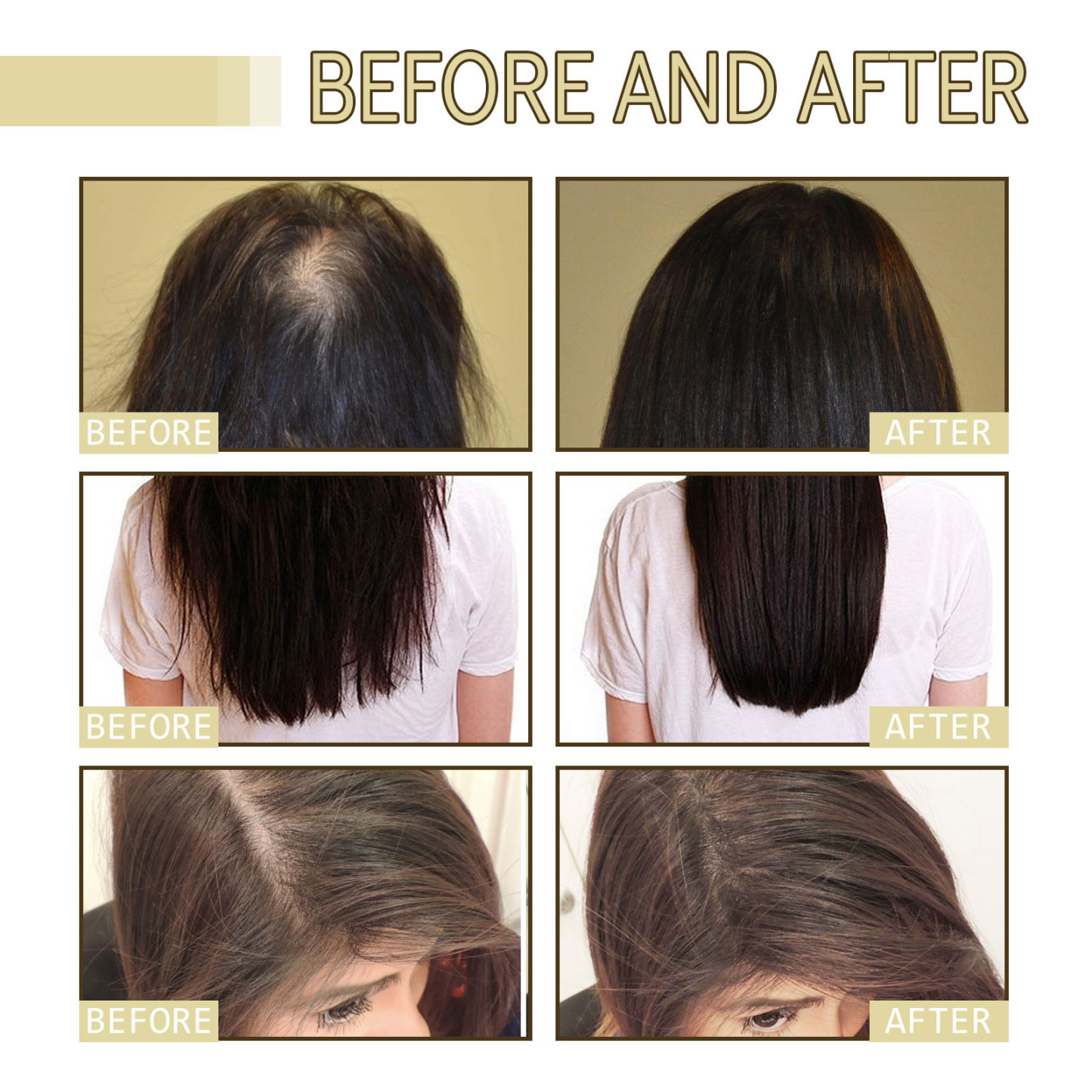 Rosemary Hair Oil – Grow & Smooth