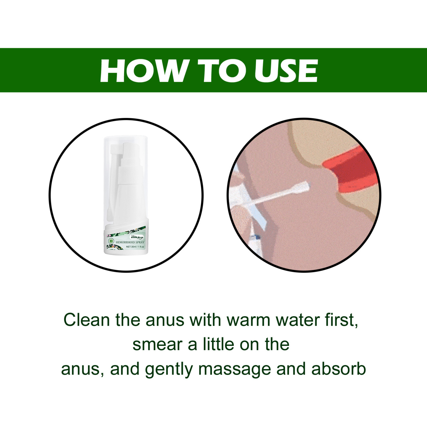 Herbal Hemorrhoid Spray – Soothe Pain & Swelling