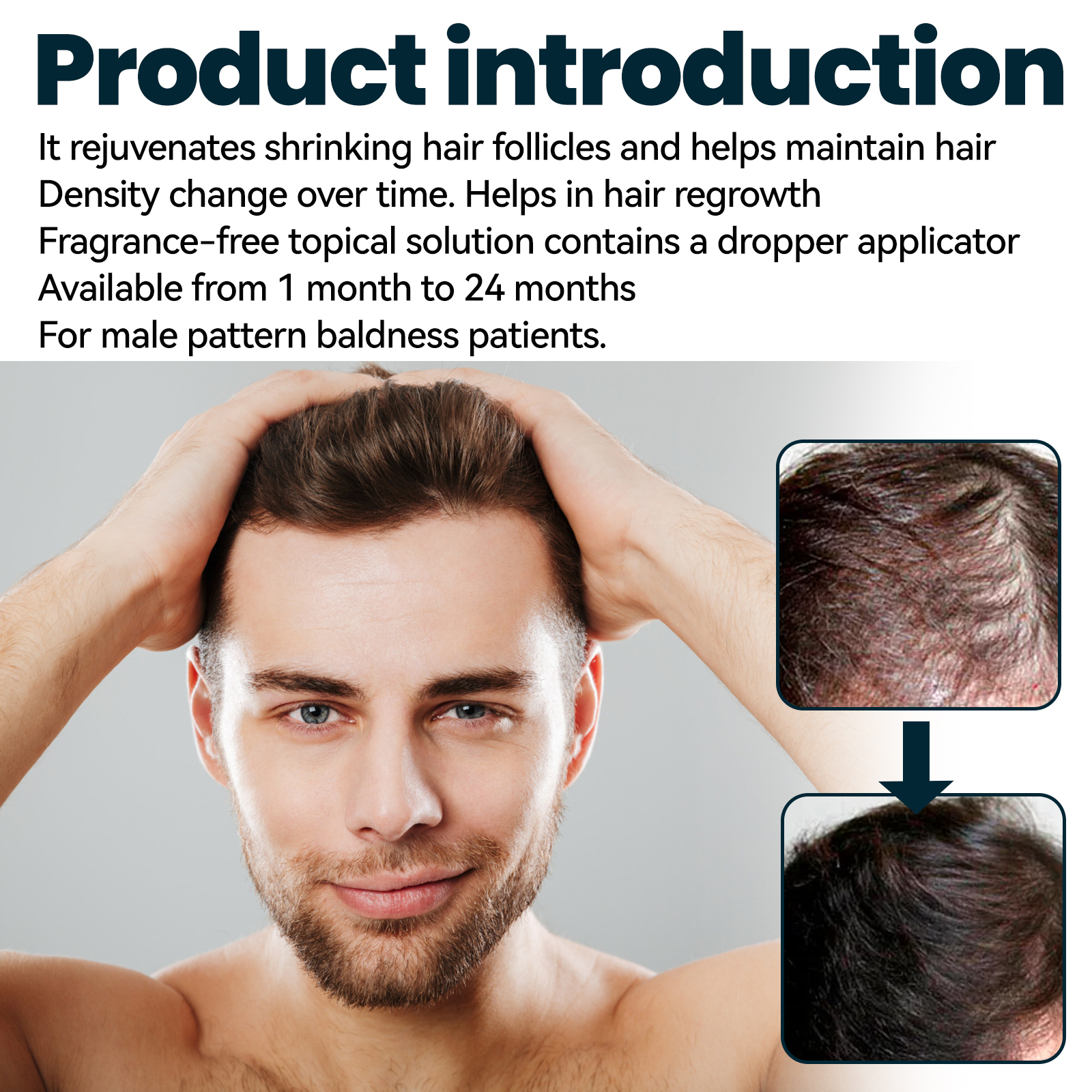 Men's Hair Growth Serum – Boost Density & Nourish Roots