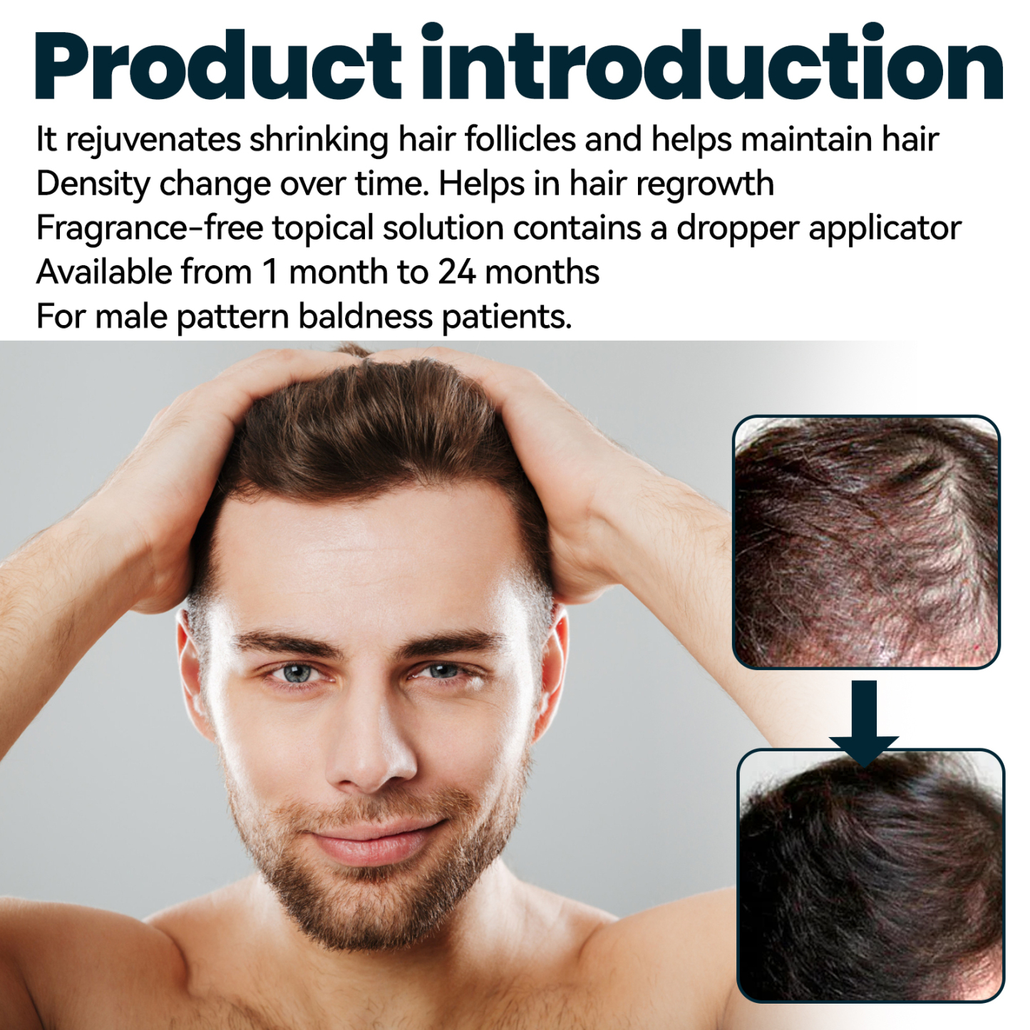 Men's Hair Growth Serum – Boost Density & Nourish Roots